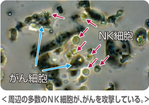 NK細胞